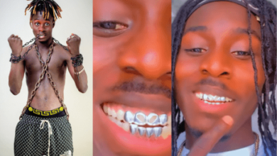 Striker De Donzy Sets Trends With Silver Fixed Teeth