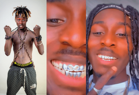 Striker De Donzy Sets Trends With Silver Fixed Teeth